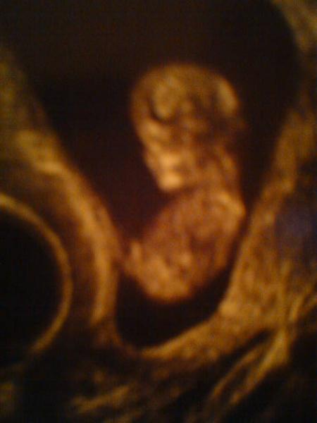 23 septembre 2008 : profil de b�b�