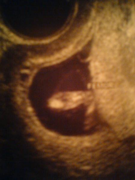 La petite jambe de b�b� ...