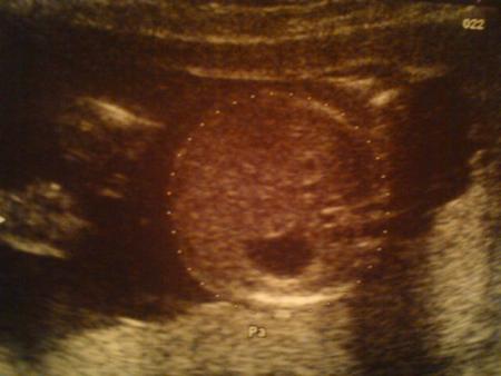 Son gros gros bidon !!!