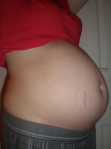 21 semaines  d'am�norrh�es