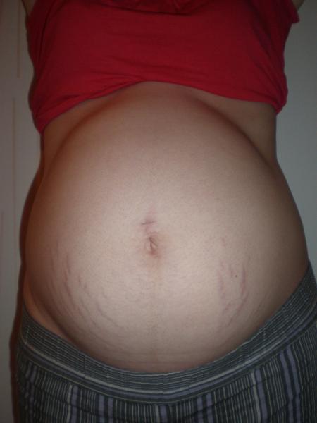 Attention photo pouvant choquer hihi